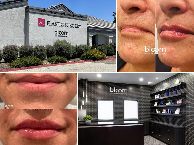 Bloom - Advanced Med Spa - Age-Defying Experts
