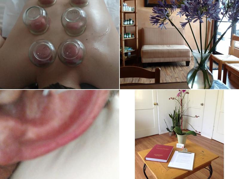 Ayurveda of Wellness Acupuncture