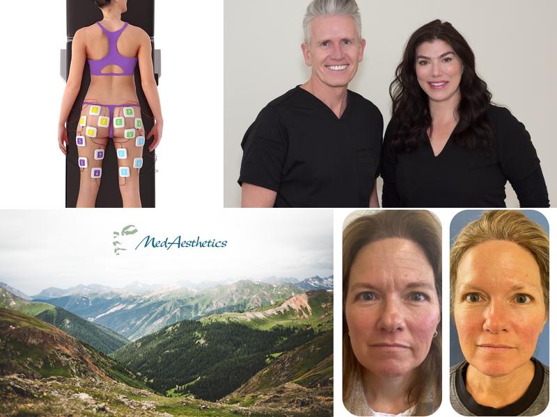 MedAesthetics