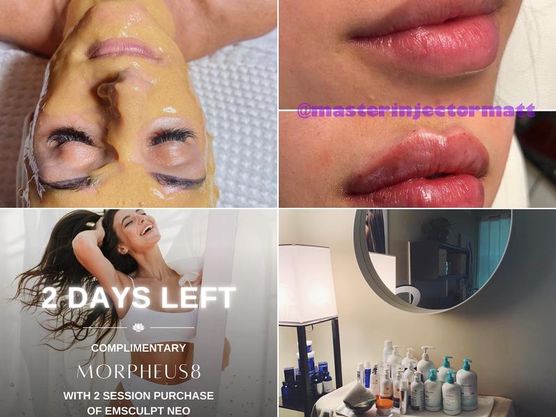 Lotus Elite Aesthetics