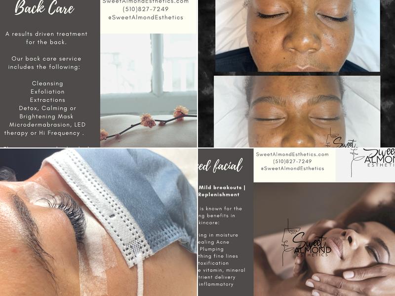 Sweet Almond Esthetics