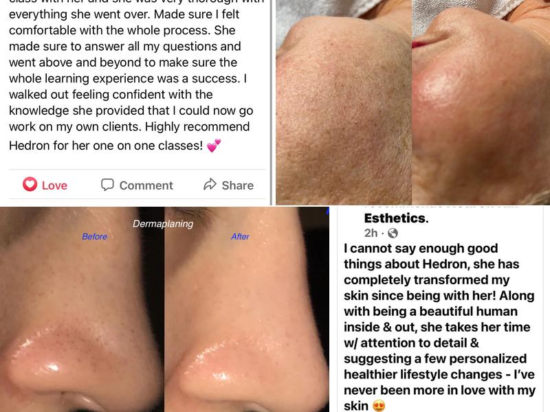 Hedron Esthetics LLC; Hedron Esthetics Academy