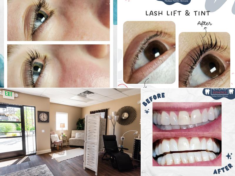 Evoke Esthetics MedSpa