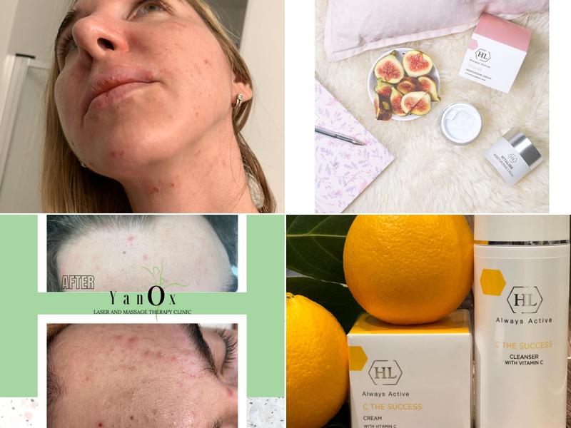 Yanox Laser and Massage Therapy Clinic