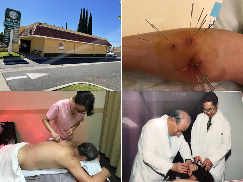 Yong S.Kim Acupuncture OC 김용석 침뜸 한의원