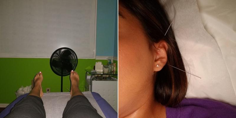 Chinese Herbs Acupuncture Center