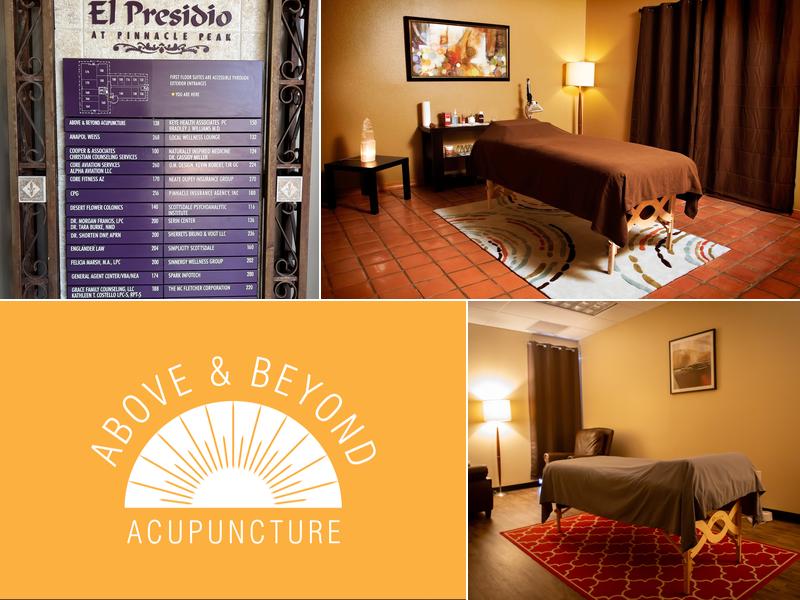 Above & Beyond Acupuncture Scottsdale