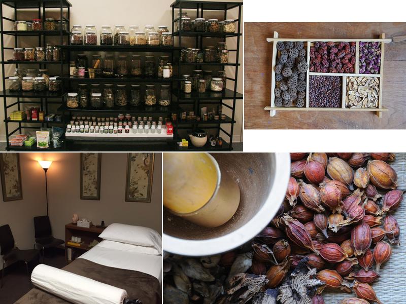 Healing Points Acupuncture