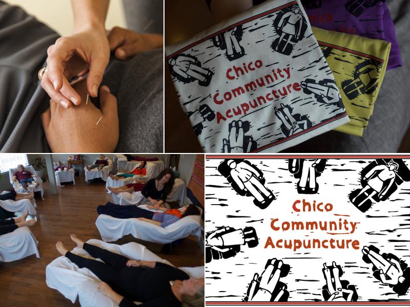 Chico Community Acupuncture