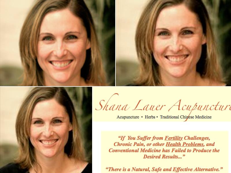 Shana Lauer Acupuncture