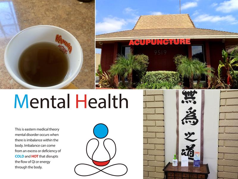 Medihand Acupuncture