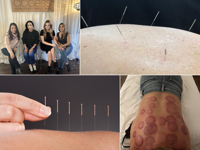 Access Acupuncture + Holistic Health
