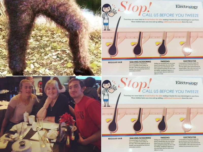 Advanced Electrolysis By Paula