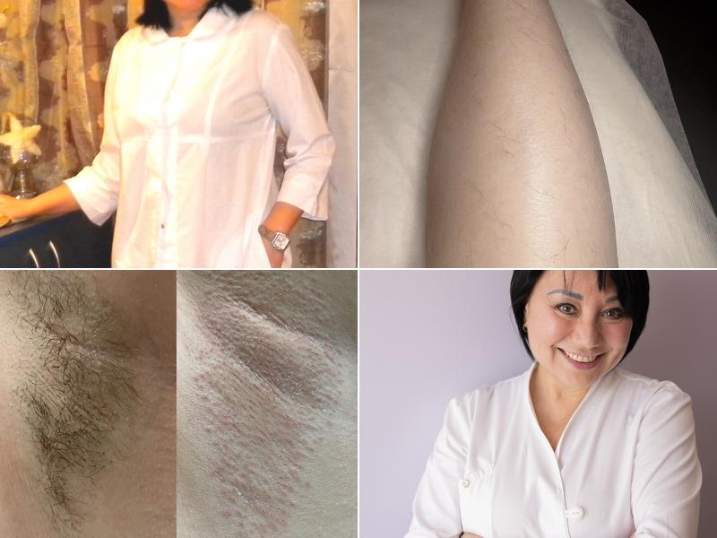 Electrolysis by Iryna