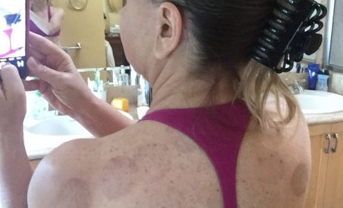 Healing Power Chinese Acupuncture 18700 Main St #205, Huntington Beach California 92648