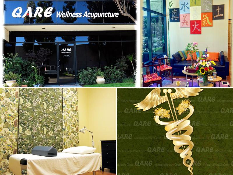 QARE Wellness Acupuncture