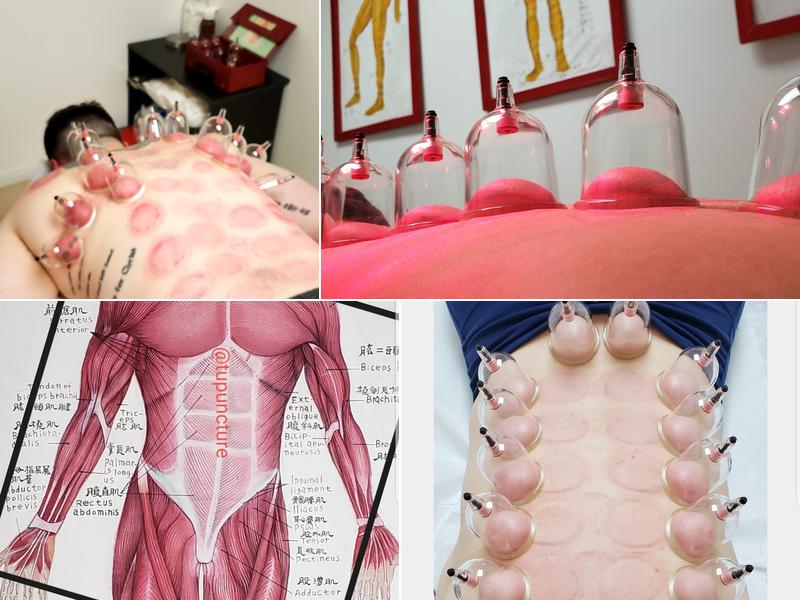 Jenny Tu Acupuncture