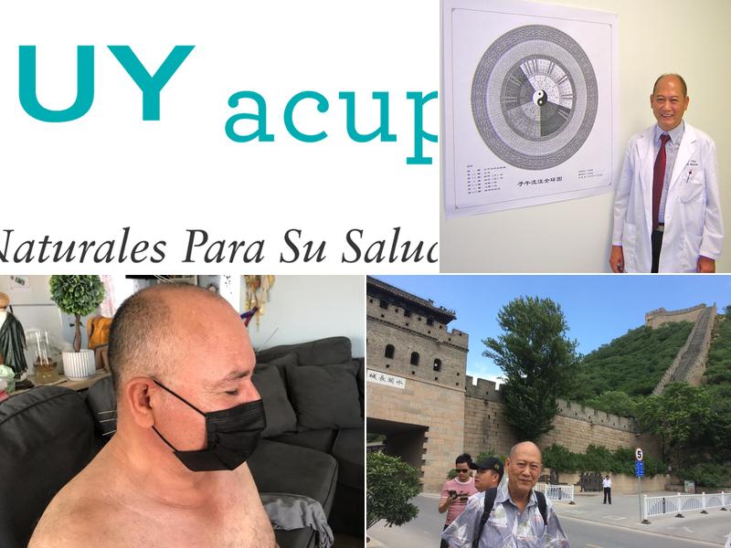 Chuy Acupuncture(Acupuntura Chuy*MENOS DOLOR)