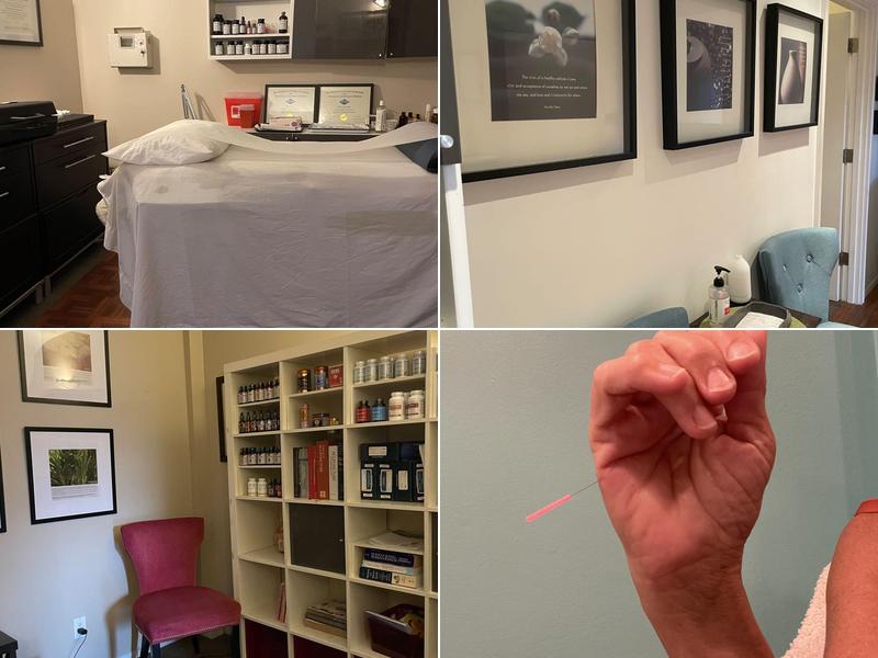 Sheri Jennings Acupuncture