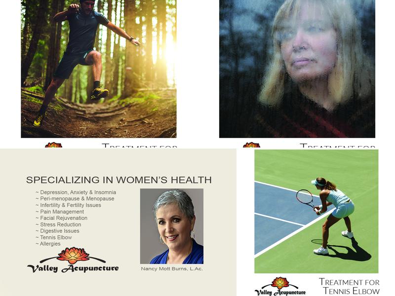 Valley Acupuncture