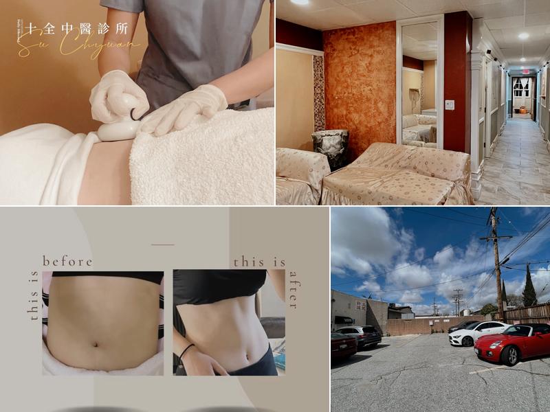 Su Chyang Acupuncture