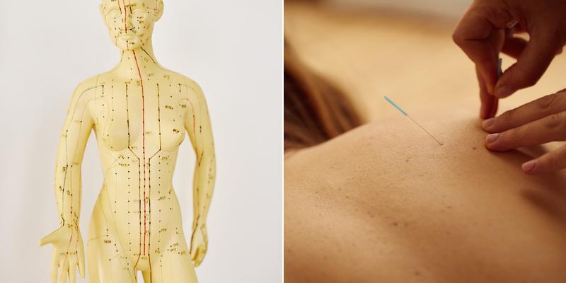 Vidor Acupuncture