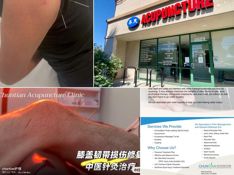 Chuntian acupuncture clinic