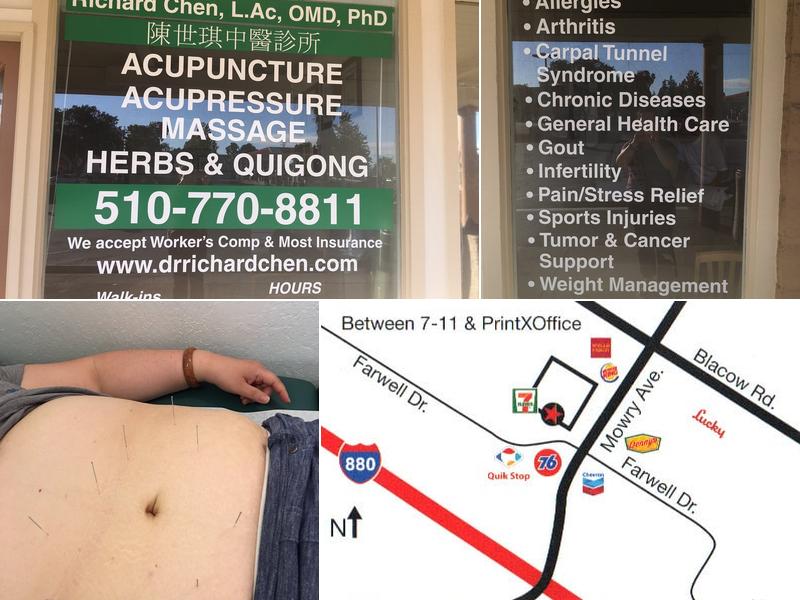 Richard Chen Acupuncture
