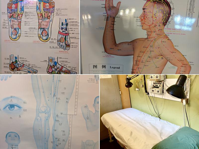 Zhang Tong Acupuncture