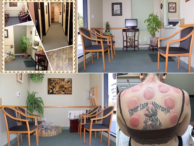 Liu Hong( Rainbow Acupuncture Temecula )