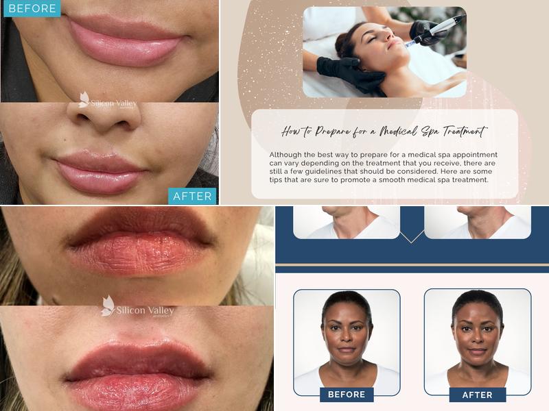 Silicon Valley Medical Spa