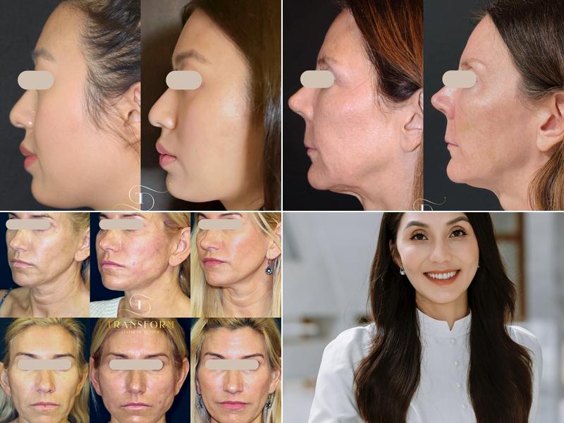 Transform Aesthetic Center LLC