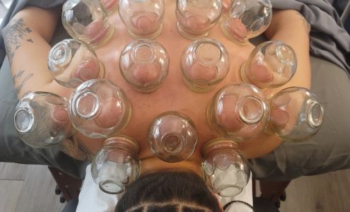 The Subtle Point Denver Acupuncture Clinic 3600 S Beeler St Suite 150, Denver Colorado 80237