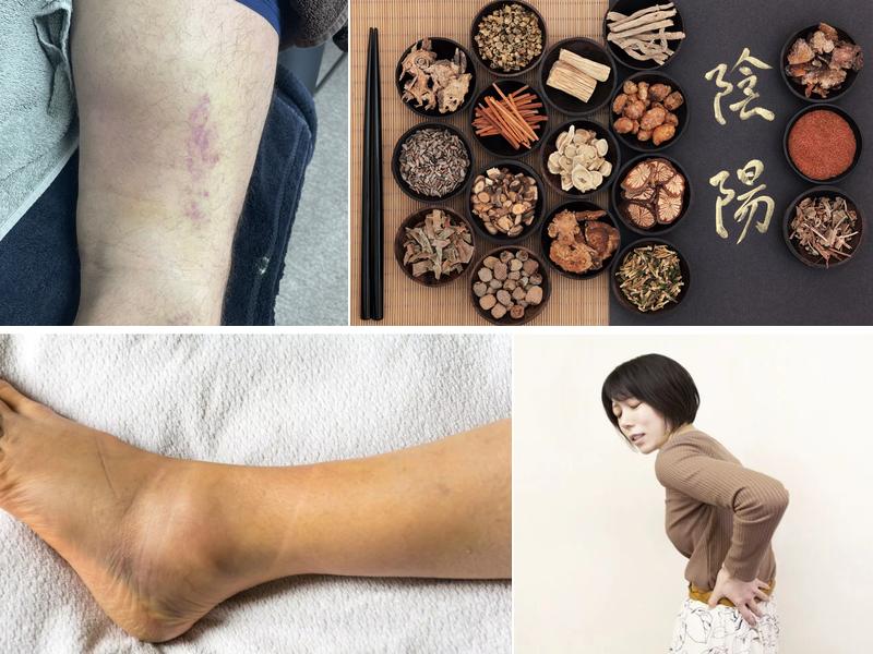 Chien's Acupuncture -Calvin Chien L.Ac.