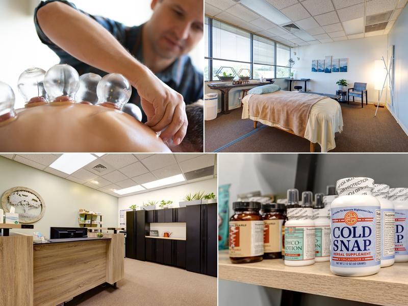 The Root Acupuncture