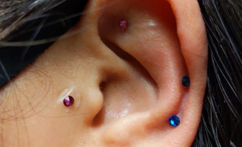 Jung Yun Acupuncture