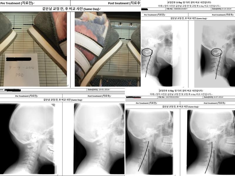 Ming Chiropractic and Acupuncture 명카이로한방병원