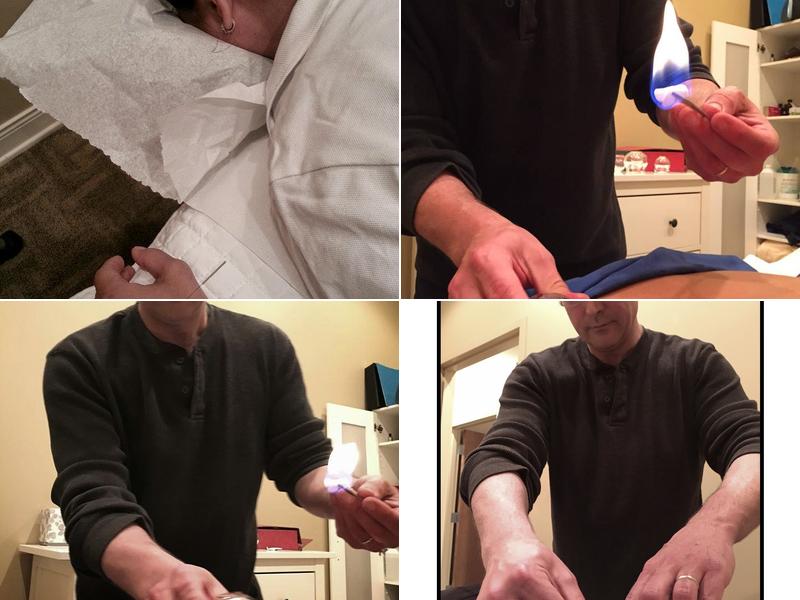 Acupuncture Center for Health and Wellness