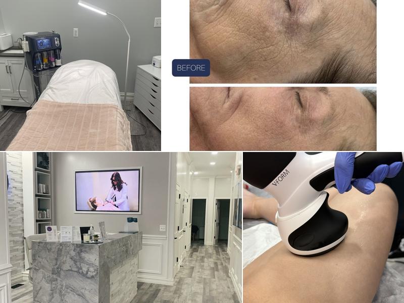 New Image Spa & Laser Center