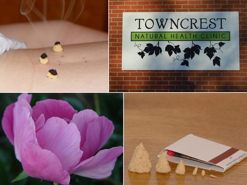 Acupuncture of Iowa, Laura Christensen LAc