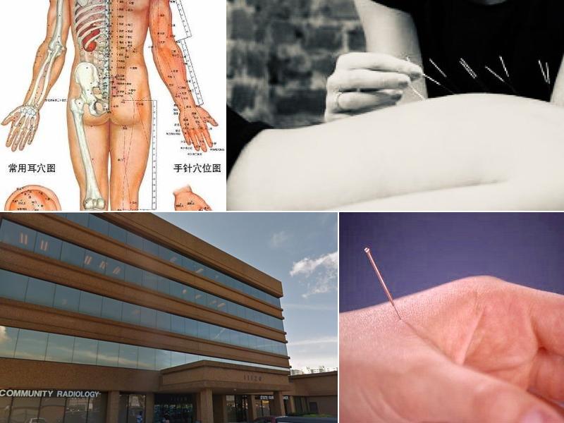 J.C ACUPUNCTURE AND CHINESE HERB CENTER