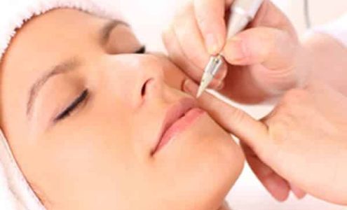 Zapster Laser & Electrolysis