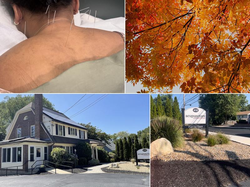 Acupuncture Connections