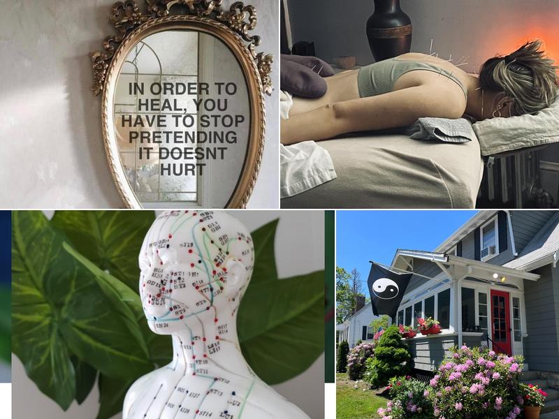 Eastern Therapeutics Acupuncture