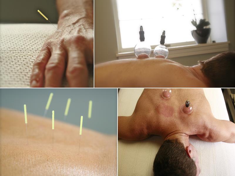 Allyson Nevard, LAc, Good Chi Acupuncture