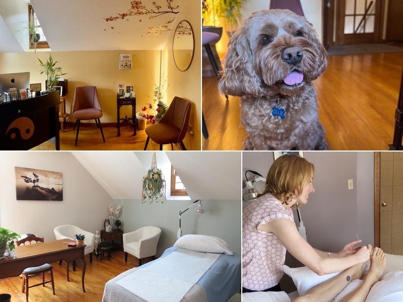 Basic Balance Acupuncture