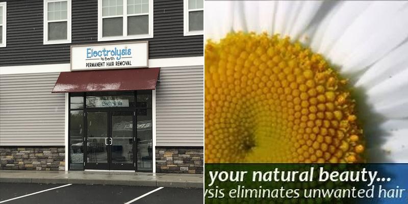 Electrolysis by Beth