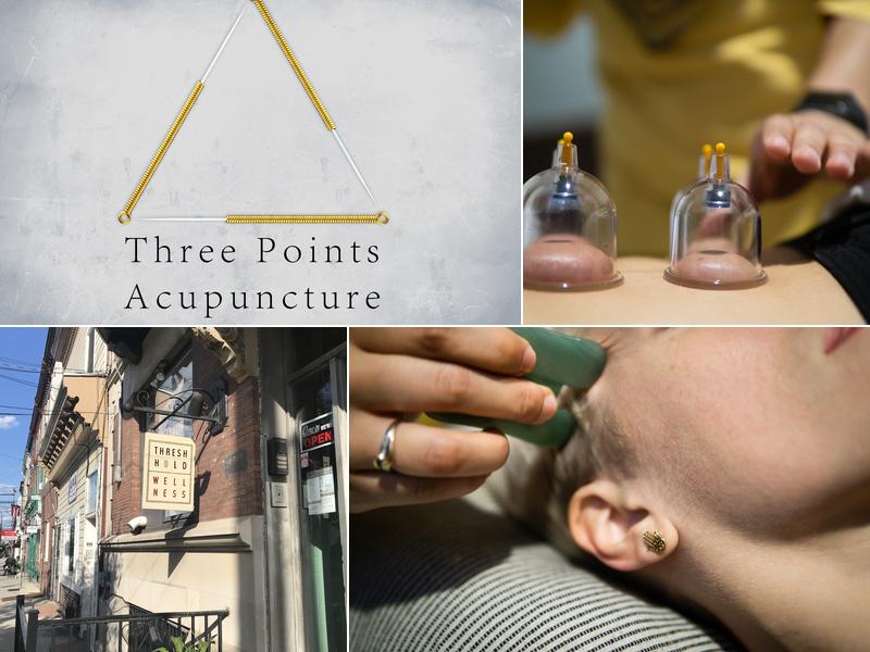 Three Points Acupuncture