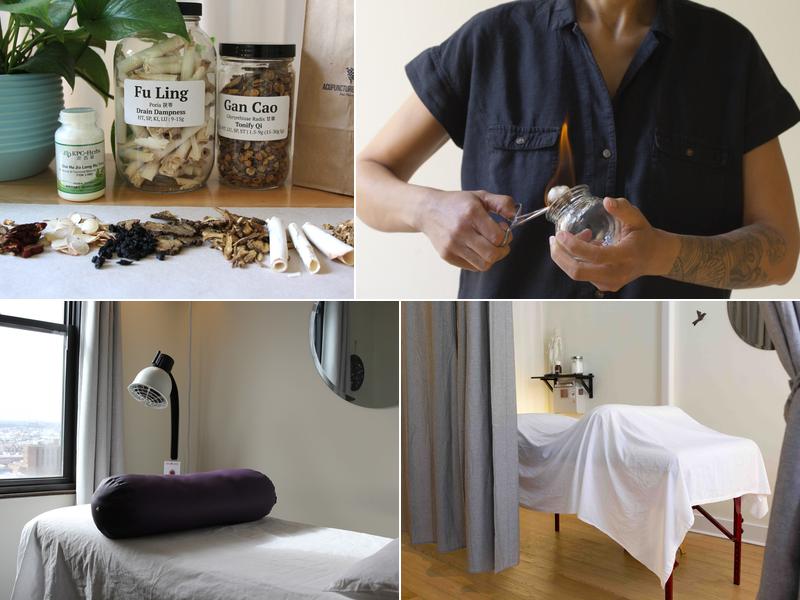 Acupuncture in Motion