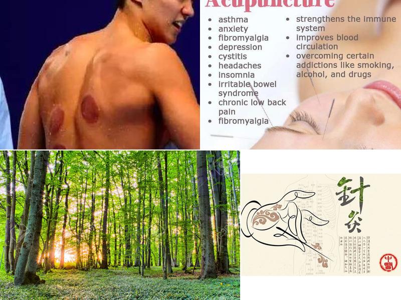 Acupuncture 健の针灸----Seeing is believing